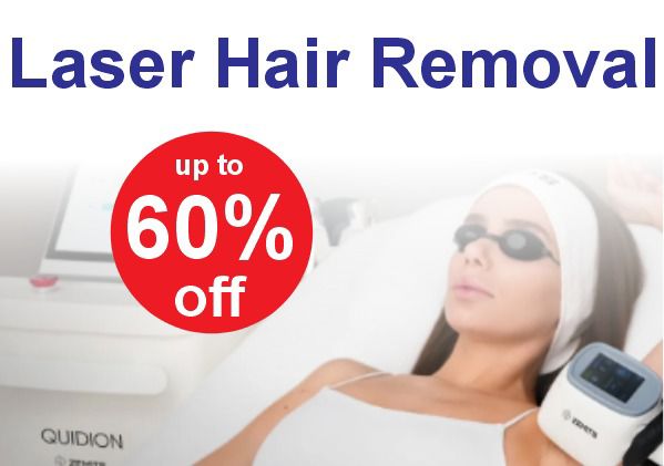 Kyluxe Laser Hair Removal Special Offer